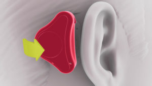 A visual image an adhear hearing aid being placed behind the ear. 